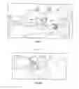 Fig. 07 - System and Device for A Fully Automated Approach to Facilitate Stellate Ganglion Block or Pulsed Radiofrequency Procedure for Treating PTSD