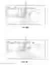 Fig. 09 - System and Device for A Fully Automated Approach to Facilitate Stellate Ganglion Block or Pulsed Radiofrequency Procedure for Treating PTSD