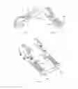 Fig. 09 - WRISTED SURGICAL INSTRUMENT CAPABLE OF MULTIPLE FUNCTIONS, WITHOUT REQUIRING EXTRA INPUTS