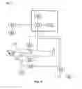 Fig. 08 - Method and system for aligning a prosthesis during surgery