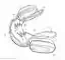 Fig. 01 - Orthodontic device