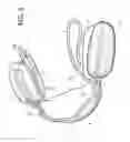 Fig. 06 - Orthodontic device