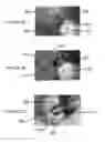 Fig. 04 - METHODS AND TOOLING FOR DENTAL IMPLANT