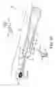 Fig. 07 - Plaque detection using a stream probe