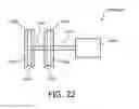 Fig. 11 - Plaque detection using a stream probe