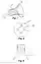 Fig. 05 - Air inject syringe dart