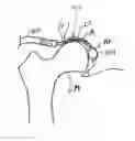 Fig. 01 - Devices and methods for minimally invasive access into a joint