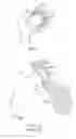 Fig. 02 - Devices and methods for minimally invasive access into a joint