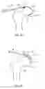Fig. 08 - Devices and methods for minimally invasive access into a joint