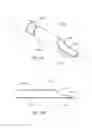 Fig. 09 - Devices and methods for minimally invasive access into a joint