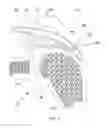 Fig. 03 - Implantable tendon protection systems and related kits and methods