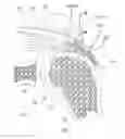 Fig. 04 - Implantable tendon protection systems and related kits and methods