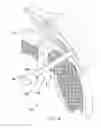 Fig. 05 - Implantable tendon protection systems and related kits and methods