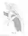 Fig. 07 - Implantable tendon protection systems and related kits and methods