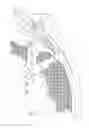 Fig. 08 - Implantable tendon protection systems and related kits and methods