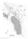 Fig. 09 - Implantable tendon protection systems and related kits and methods