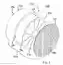 Fig. 10 - Implantable tendon protection systems and related kits and methods