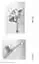 Fig. 09 - Acetabular cup impacting using patient-specific instrumentation