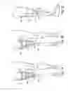Fig. 02 - Alignable coupling assembly for connecting two prosthetic limb components