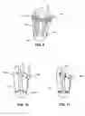 Fig. 07 - Modular prosthetic sockets and methods for making same