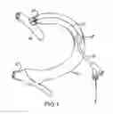 Fig. 02 - Method and Device for Treating a Target Site in a Vascular Body Channel