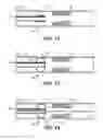 Fig. 07 - Method and Device for Treating a Target Site in a Vascular Body Channel