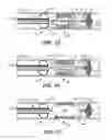 Fig. 08 - Method and Device for Treating a Target Site in a Vascular Body Channel