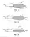 Fig. 09 - Method and Device for Treating a Target Site in a Vascular Body Channel