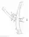 Fig. 02 - Methods and apparatus for luminal stenting