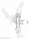 Fig. 07 - Methods and apparatus for luminal stenting