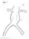 Fig. 02 - Push and pull medical device delivery system