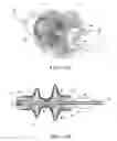 Fig. 07 - Gastrointestinal device
