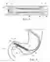 Fig. 09 - Gastrointestinal device