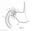 Fig. 02 - Gastrointestinal device