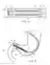 Fig. 09 - Gastrointestinal device