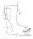Fig. 01 - Prefabricated walking boot