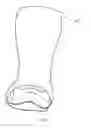 Fig. 02 - Prefabricated walking boot