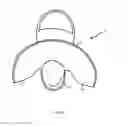 Fig. 04 - Prefabricated walking boot