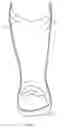 Fig. 06 - Prefabricated walking boot