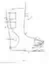 Fig. 07 - Prefabricated walking boot