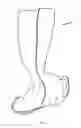 Fig. 08 - Prefabricated walking boot