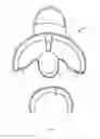 Fig. 09 - Prefabricated walking boot