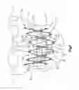 Fig. 02 - Flexible maxillo-mandibular fixation device