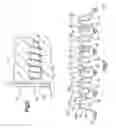 Fig. 06 - Flexible maxillo-mandibular fixation device