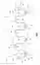 Fig. 08 - Flexible maxillo-mandibular fixation device