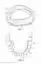 Fig. 02 - MANDIBULAR ADVANCEMENT DEVICE