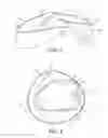 Fig. 03 - MANDIBULAR ADVANCEMENT DEVICE