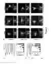 Fig. 02 - Composition and method for treating neuronal ceroid lipofuscinosis