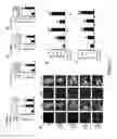 Fig. 03 - Composition and method for treating neuronal ceroid lipofuscinosis