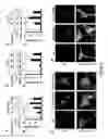 Fig. 04 - Composition and method for treating neuronal ceroid lipofuscinosis